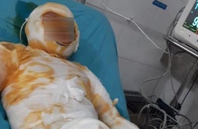 Khởi tố kẻ tưới xăng đốt vợ ở Thái Bình