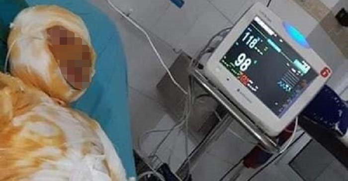Người vợ bị chồng tưới xăng đốt ở Thái Bình không qua khỏi
