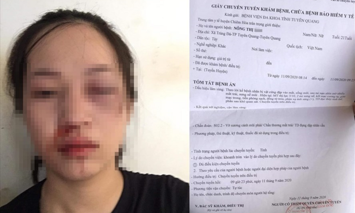 CSGT bị tố vụt gậy vào mặt người phụ nữ đi xe máy: Công an Tuyên Quang lên tiếng