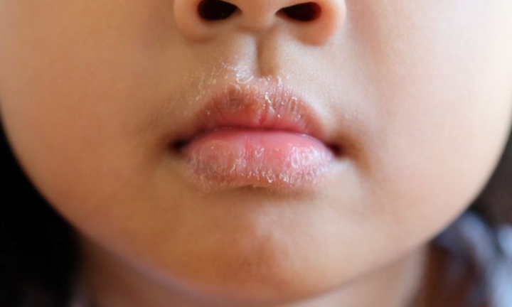 Những thay đổi bất thường trên cơ thể cảnh báo bệnh nguy hiểm