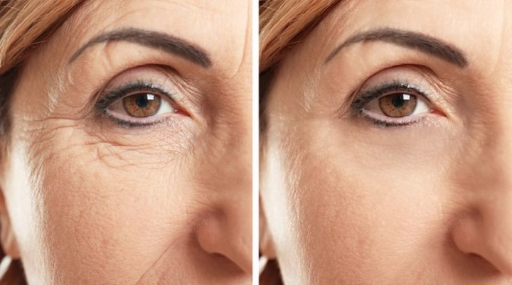 Bỏ ngay những thói quen này nếu không muốn nếp nhăn hình thành sớm