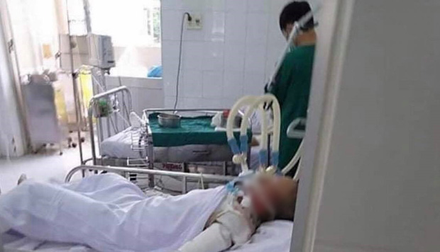 Bé gái 15 tuổi bị bạn trai tưới xăng đốt ở Bình Dương không qua khỏi 