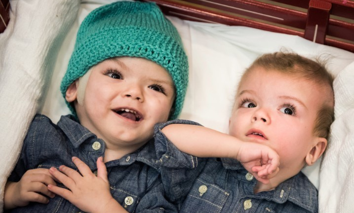 Sau tách rời, các cặp song sinh dính liền được chăm sóc thế nào?