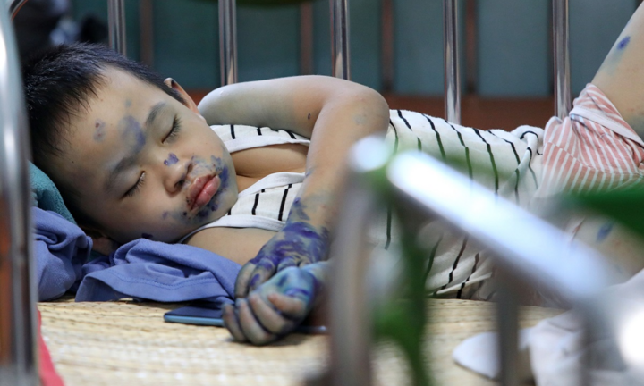 Ảnh: Bệnh chân tay miệng gia tăng nhanh ở TP.HCM
