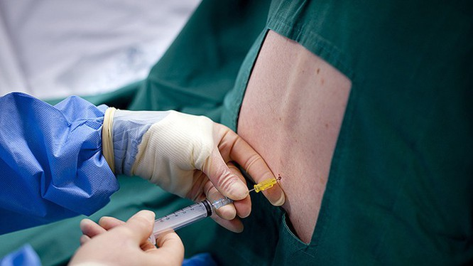 Sản phụ ở Quảng Ngãi chết thương tâm sau gây tê tủy sống