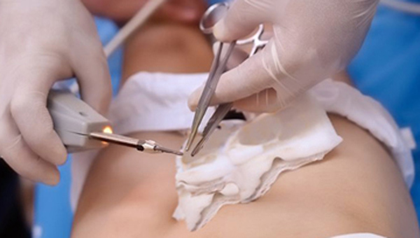 Chàng trai miền Tây đau đớn nhập viện vì gãy dương vật