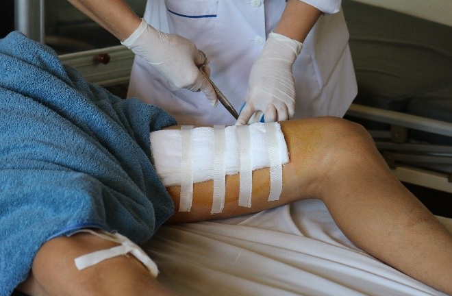 Bình rượu ổi ngâm một năm phát nổ, nam thanh niên bị thương nặng phải cấp cứu