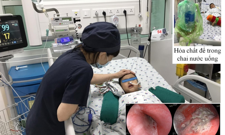 Cứu sống bé trai 3 tuổi ở miền Tây uống nhầm hoá chất