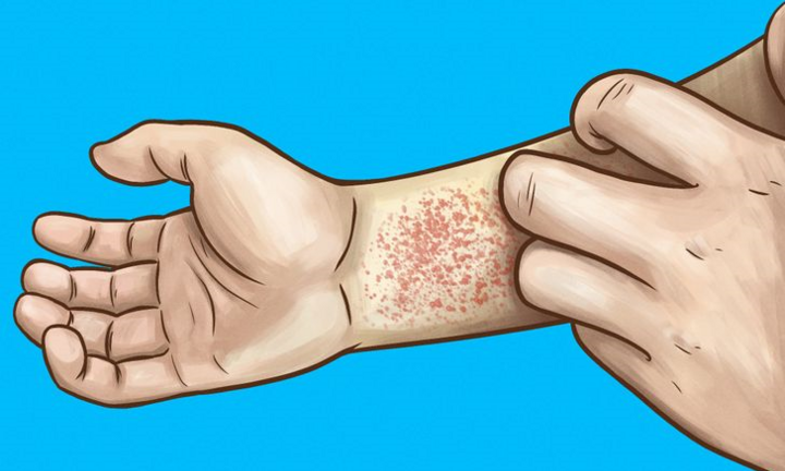 Những dấu hiệu cho thấy thận của bạn đang có vấn đề