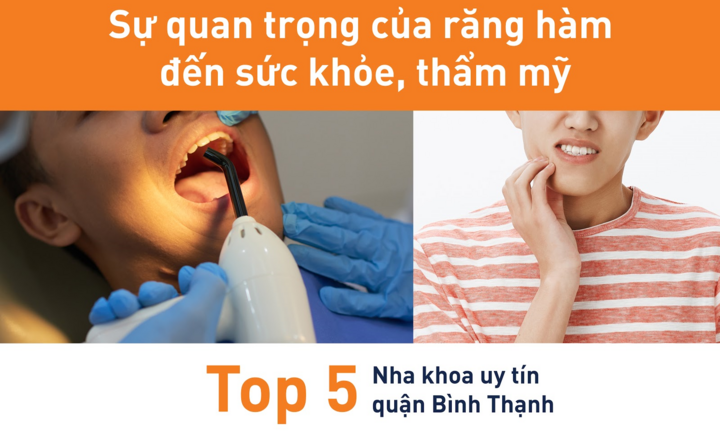 Top 5 nha khoa uy tín quận Bình Thạnh, TP.HCM