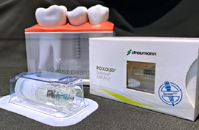 Trồng răng Implant All on 4, All on 6 có tốt?