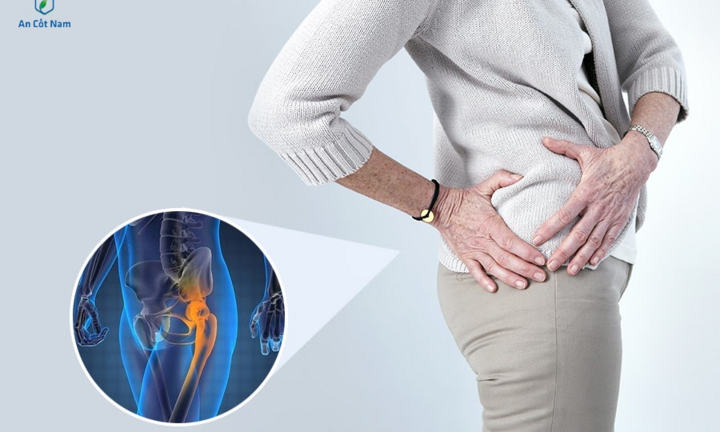 Bác sĩ Nguyễn Bá Vưỡng chia sẻ về chứng đau từ thắt lưng xuống mông 