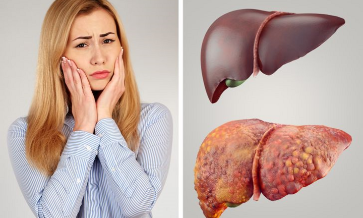 Dấu hiệu cảnh báo cơ thể bạn đang chứa đầy chất độc