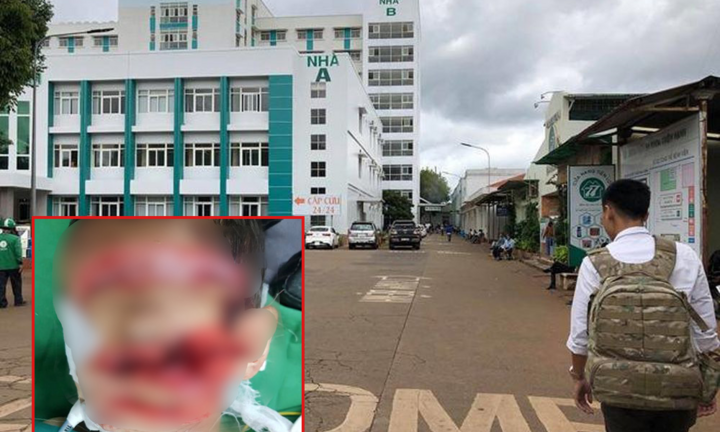  Mẹ bỏ nhà đi, cha chém con trai 5 tuổi nguy kịch