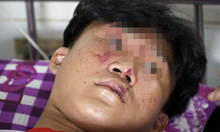 Ba học sinh ở Đồng Tháp bị nhóm người lạ vào tận trường lôi ra ngoài đánh dã man
