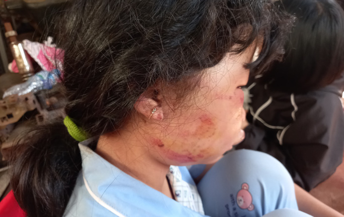 Bắt nam thiếu niên đánh nữ sinh lớp 6 bất tỉnh trong lô cao su