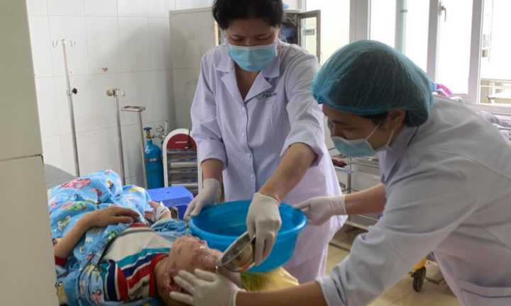 Học clip trên mạng, bé trai tự mua cồn về đốt gây bỏng nặng