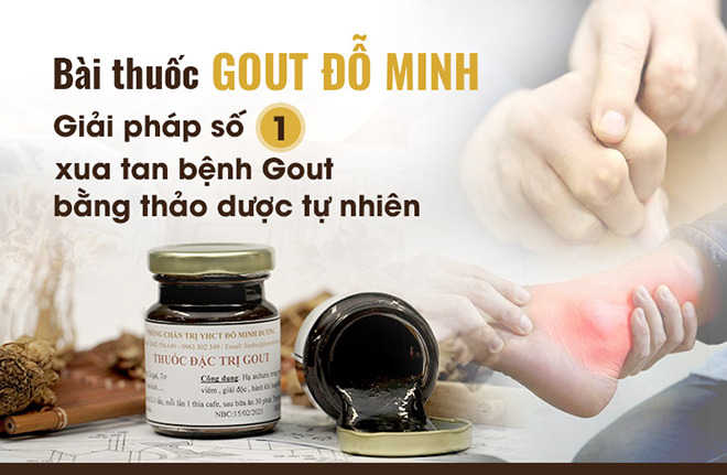 Đối phó với bệnh Gout lâu năm nhờ bài thuốc Gout Đỗ Minh 150 năm tuổi