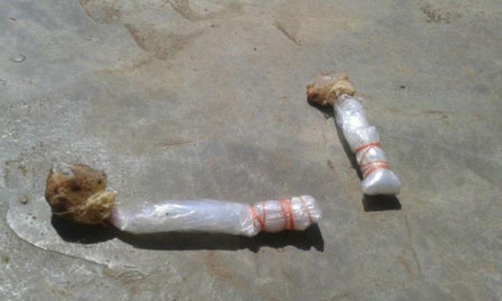 Ăn nhầm kẹo mút bả chó, bé gái 4 tuổi chết thương tâm