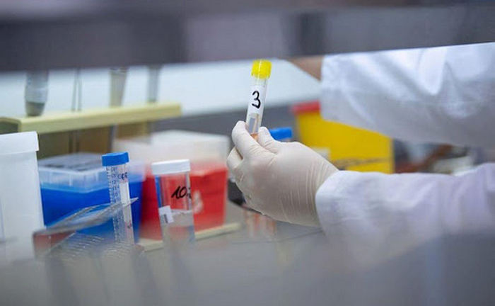 TP.HCM: 107 trường hợp liên quan đến BN 2910 âm tính với SARS-CoV-2