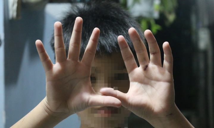 Sự thật thông tin bé trai bị cha đánh dập tay ở TP.HCM