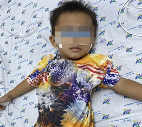 Bé trai 30 tháng tuổi nguy kịch do uống dung dịch tẩy mực in