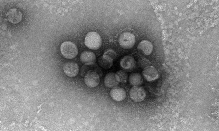 Phát hiện chủng virus corona mới có nguồn gốc từ động vật