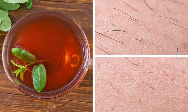  8 mẹo đơn giản làm mờ lông trên cơ thể