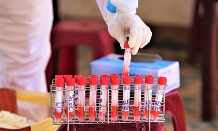 Nhân viên bảo trì ở Quảng Nam nhiễm SARS-CoV-2, từng đi chụp ảnh đám cưới