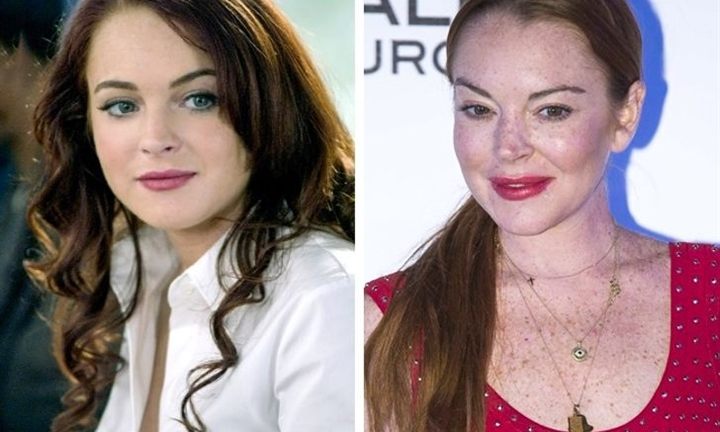 Ảnh: Gương mặt người nổi tiếng thay đổi thế nào sau phẫu thuật thẩm mỹ?