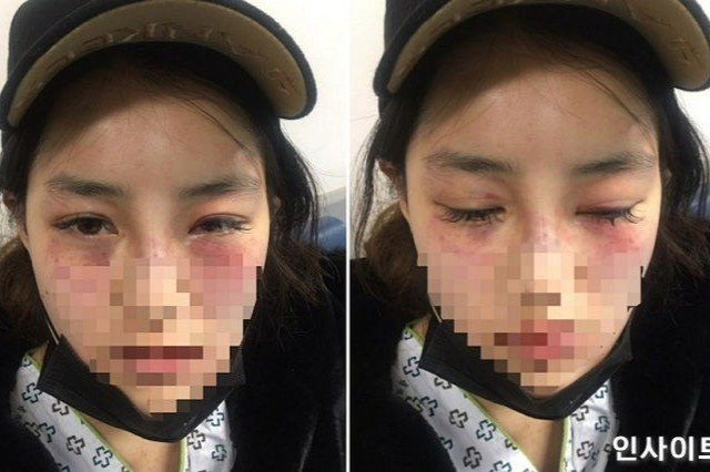 Cuộc sống địa ngục của những cô gái Hàn Quốc có bạn trai vũ phu