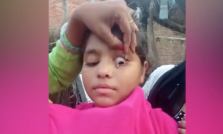 Video: Kinh ngạc thiếu nữ khóc ra 'đá' ở Ấn Độ