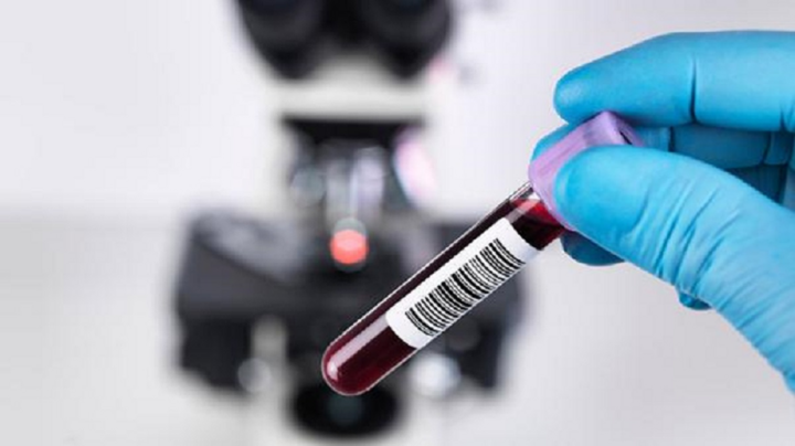 Người tiêm 2 mũi vaccine COVID-19 có cần làm xét nghiệm kháng thể? 