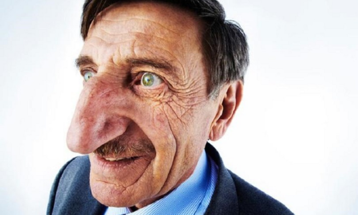 Người đàn ông có chiếc mũi dài nhất thế giới