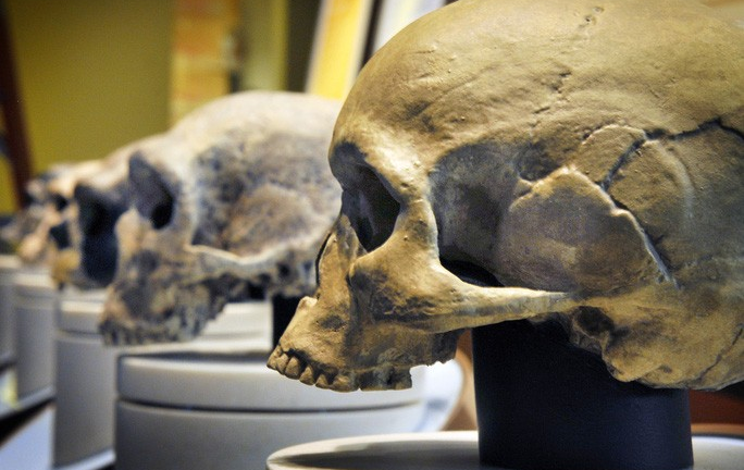 3.000 năm trước, não loài người bị thu nhỏ lại