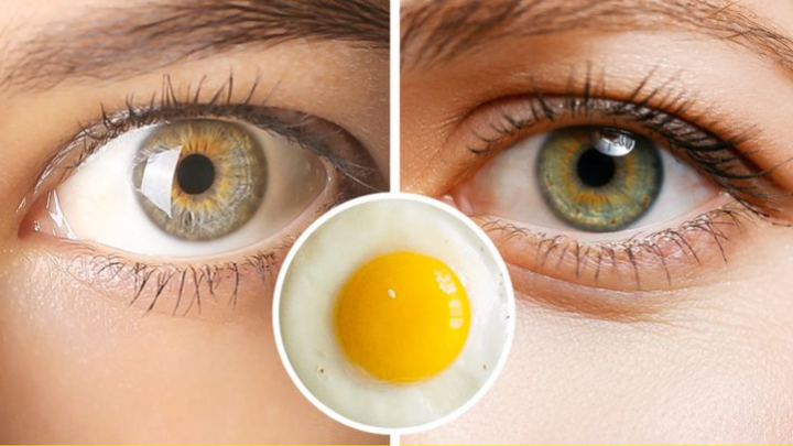 7 loại thực phẩm giúp 'khuếch đại' vẻ đẹp hút hồn cho đôi mắt: Càng ăn càng đẹp