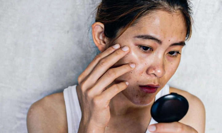 Nhận biết 'khuôn mặt ung thư' với 3 dấu hiệu nguy hiểm dễ thấy