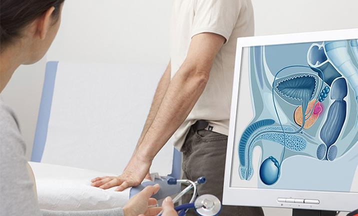 Gần một nửa đàn ông không biết gì về căn bệnh ung thư rủi ro hàng đầu ở nam giới