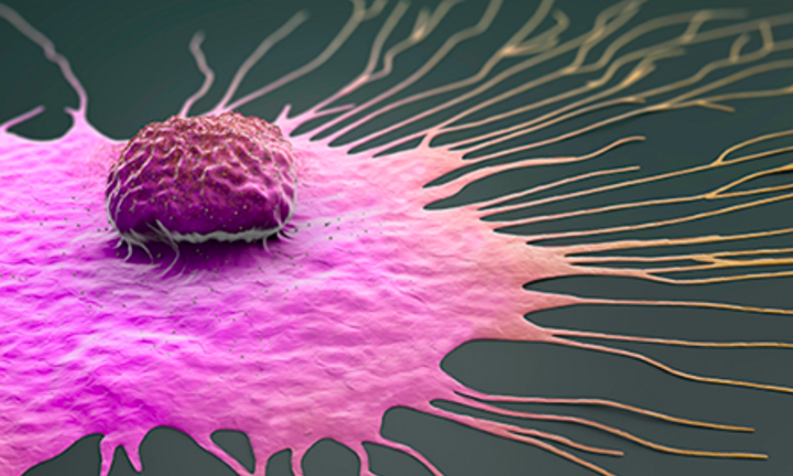 10 điều ‘sát sườn’ để ngăn ung thư phát triển: Cần phải làm ngay từ khi còn trẻ