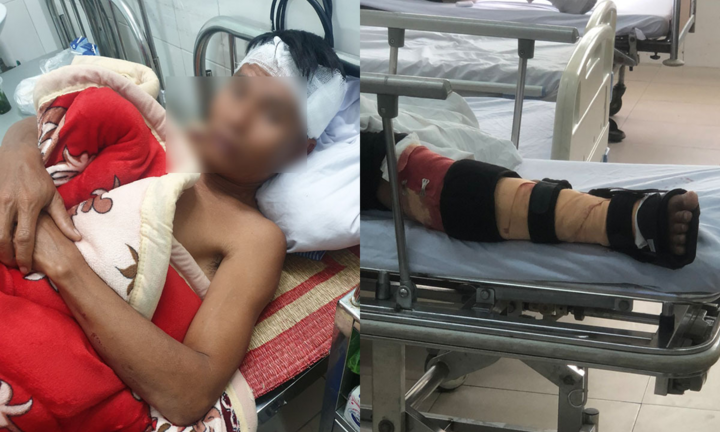 Truy tìm nhóm côn đồ đâm chém dã man 3 ngư dân trên biển Hải Phòng