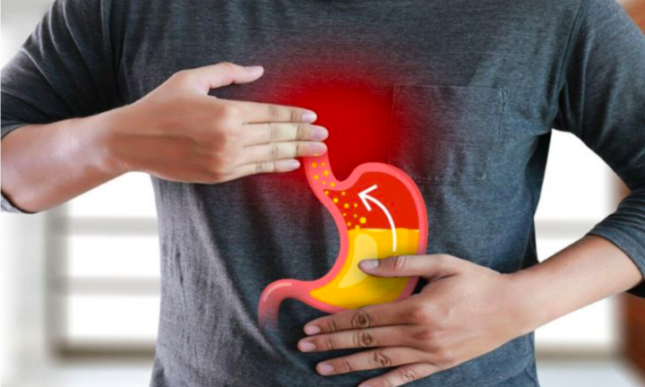 Đầy bụng sau khi ăn có nguy hiểm không: Nên làm ngay 4 việc trước khi gặp bác sĩ