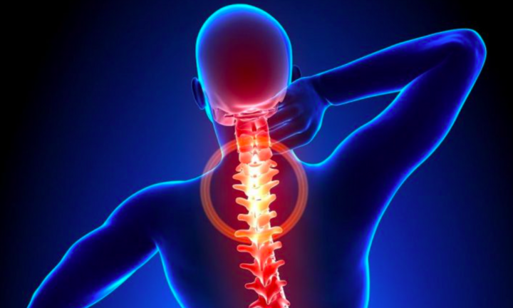 Có 4 trong 9 triệu chứng này thì bạn đã bị bệnh thoái hóa đốt sống cổ 'gọi tên'