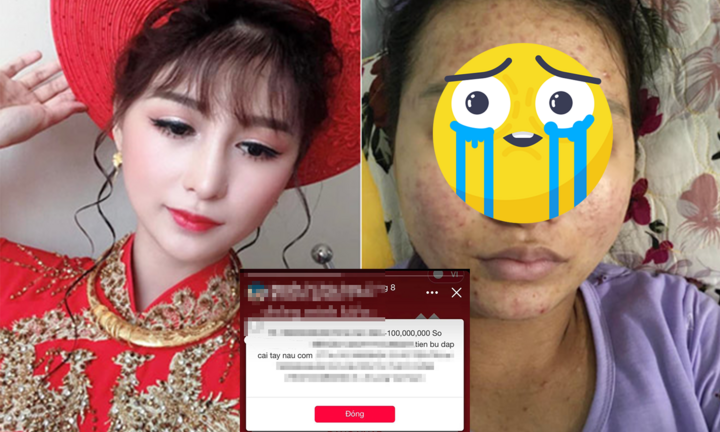 Thấy vợ xuống sắc, anh chồng chuyển 100 triệu tới tấp để bù đắp gây sốt MXH