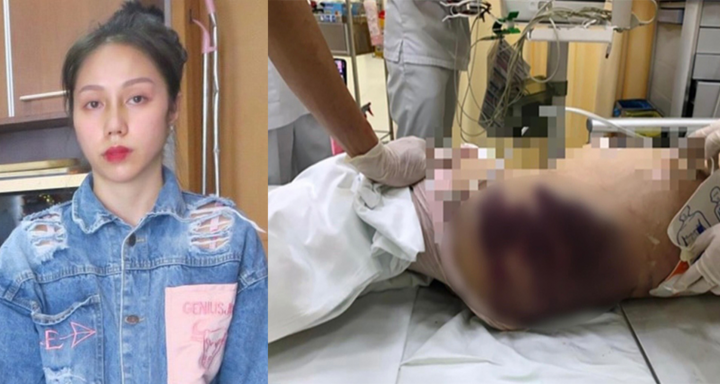 Khởi tố bổ sung tội giết người với 'dì ghẻ' hành hạ bé gái 8 tuổi tới chết