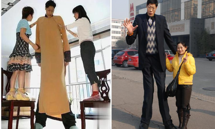 Cuộc đời gã 'quái vật' cao hơn 2m4 nhiều bất hạnh và cái kết viên mãn khó tưởng