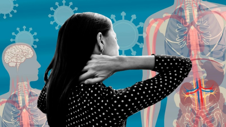 Phát hiện mới về triệu chứng COVID-19 kéo dài