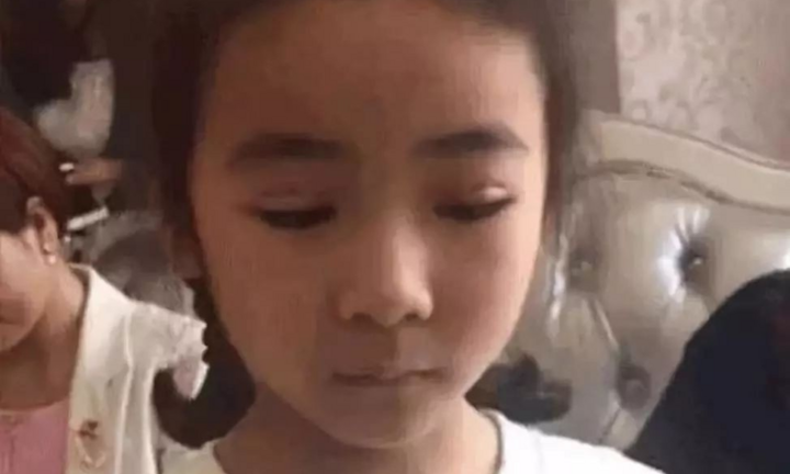 Bà mẹ đưa con gái 7 tuổi đi cắt mí mắt khiến dân mạng bức xúc