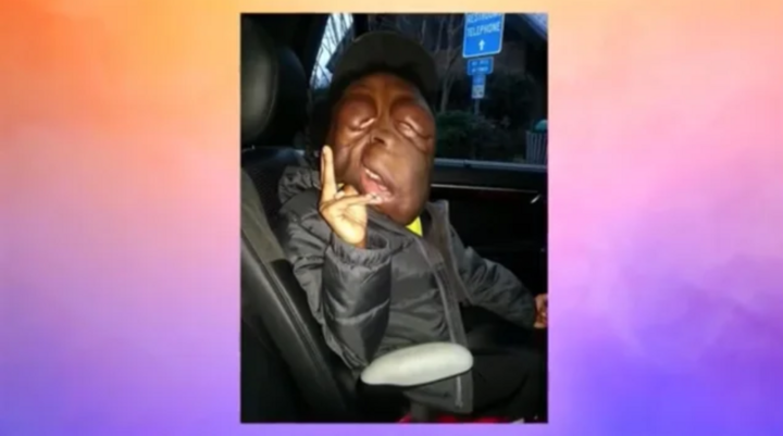 Xót xa hình ảnh hiện tại của cậu bé mang ‘gương mặt quỷ’ gây xôn xao 5 năm trước