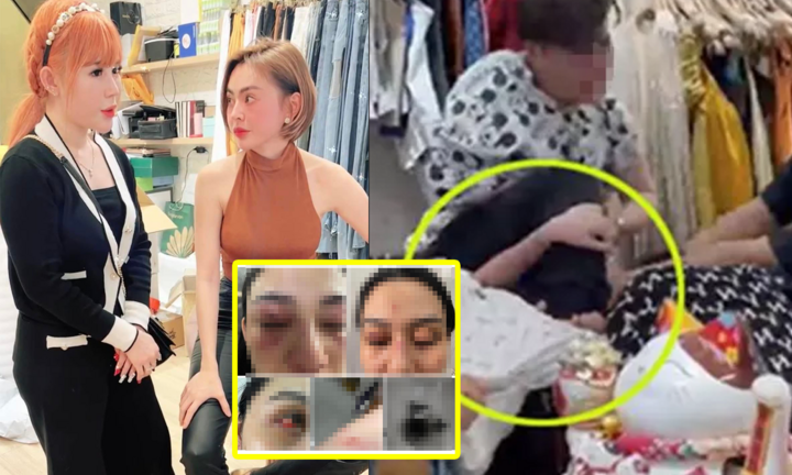 Toàn cảnh vụ 2 hot girl ẩu đả trên livestream: Kẻ vào viện, kẻ tiếp tục bán hàng