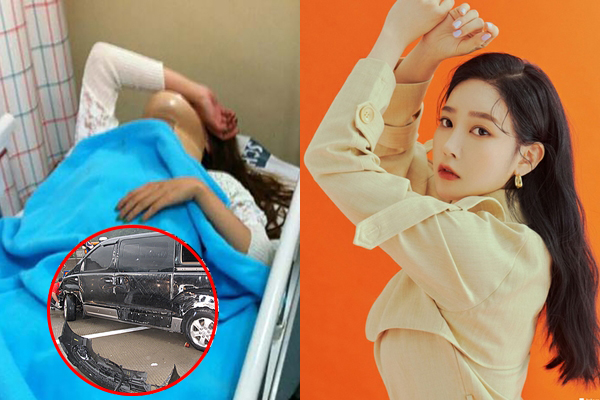 Mặt mũi biến dạng vì tai nạn, ca sĩ Hàn lột xác và có cái kết mỹ mãn sau 10 năm